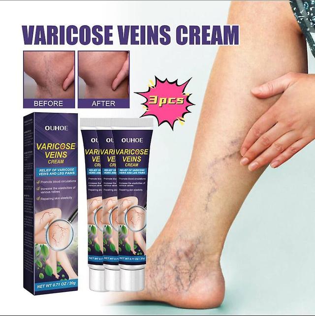 OUHOE Vein Repair Cream relieves leg pain, swelling and raised veins, earthworm leg vein massage care cream Massage Oil1PCS) 3PCS on Productcaster.