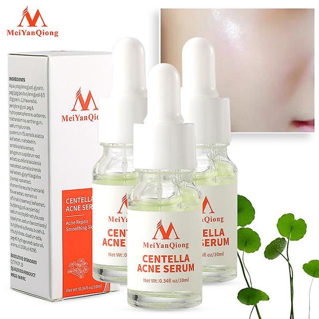 1mor 3pcs/lotmeiyanqiong Centella Asiatica Acne Extract Removes Acne, Eliminates Acne Marks, Controls Oils, And Whitens Skin 10ml on Productcaster.