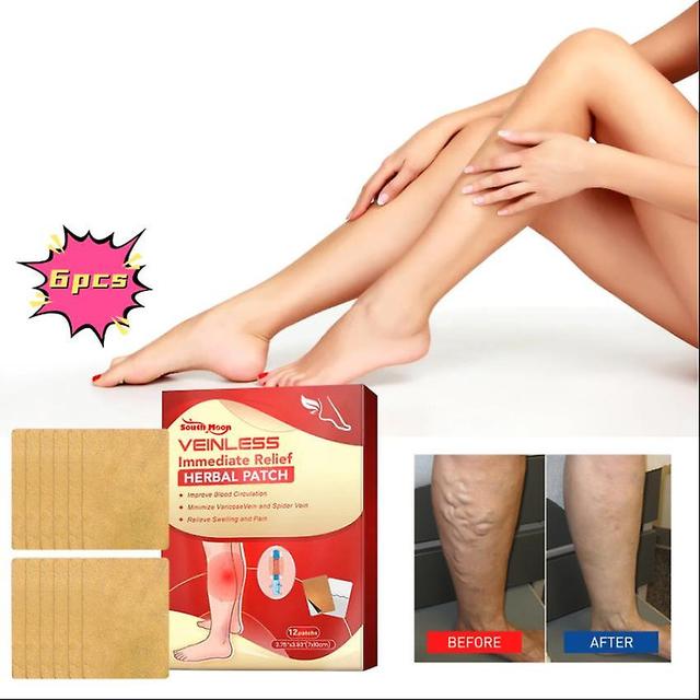 South Moon Varicose Care Herbal Patch Leg Massage Relieve Soreness Earthworm Leg Vein Care Patch Massage Oil1PCS) 6PCS on Productcaster.