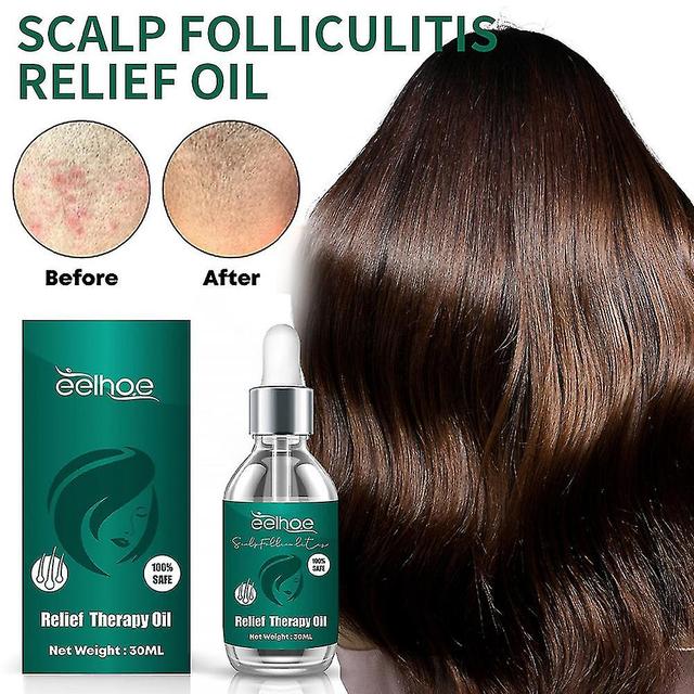 Mike Mike Scalp Folliculitis Relief Therapy Oil 100% Safe 30ml on Productcaster.