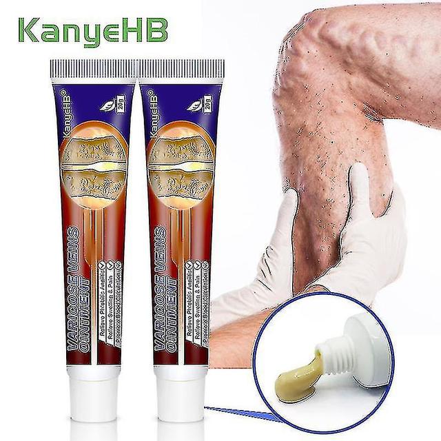 2pcs Varicose Cream Swollen Vessels Varicocele Vasculitis Cream Varices Cream A851 on Productcaster.