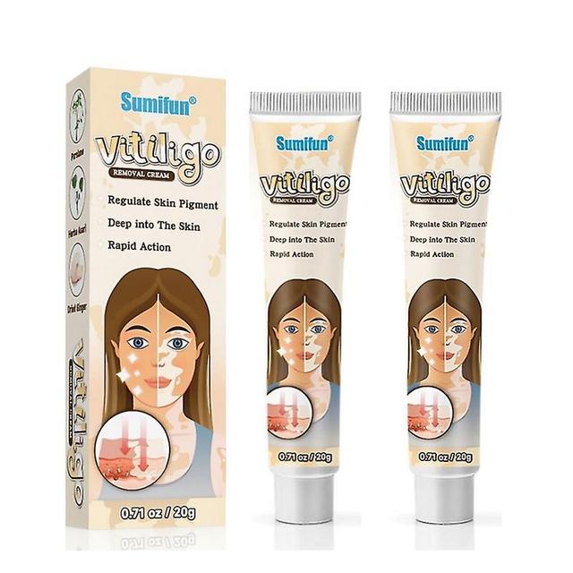 2pcs Herbal Extract Vitiligo Ointment Remove Ringworm White Spot Removal Skin Vitiligo Eliminate Vitiligo Treatment Cream on Productcaster.