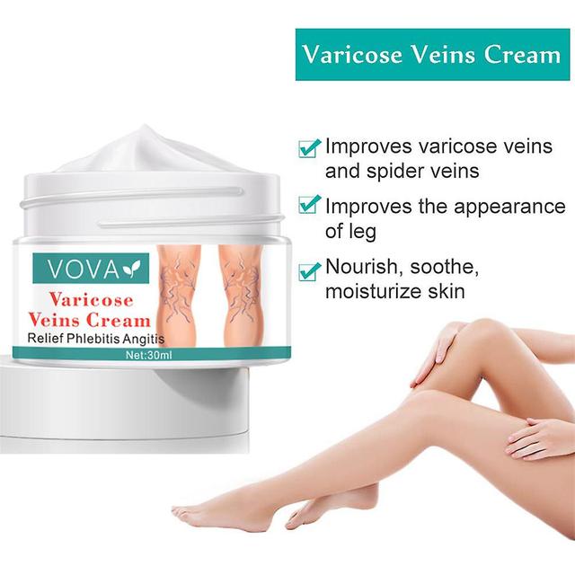 Varicose Vein Cream Vasculitis Phlebitis Pain Spider Legs Ointment Health Care Body Care on Productcaster.