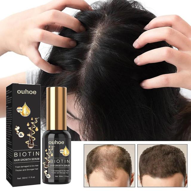 Hair Growth Products, Biotin, Fast Growing Hair Care, Essential Oil, Hair Loss Spray, Skin Nursing, on Productcaster.