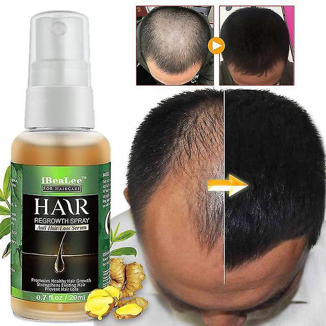 Wosawe Hair Care Hair Growth Essential Oils Essence Hair Loss Liquid Health Care Beauty Dense Hair Growth Serum on Productcaster.