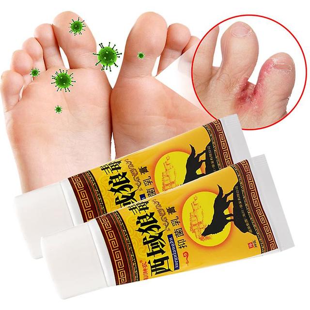 Qian 2pcs Psoriasis Treatmemt Chinese Herbal Medicine Cream Cure Eczematoid Eczema Dermatitis Seborreica Wolf Poison Medical Plaster on Productcaster.