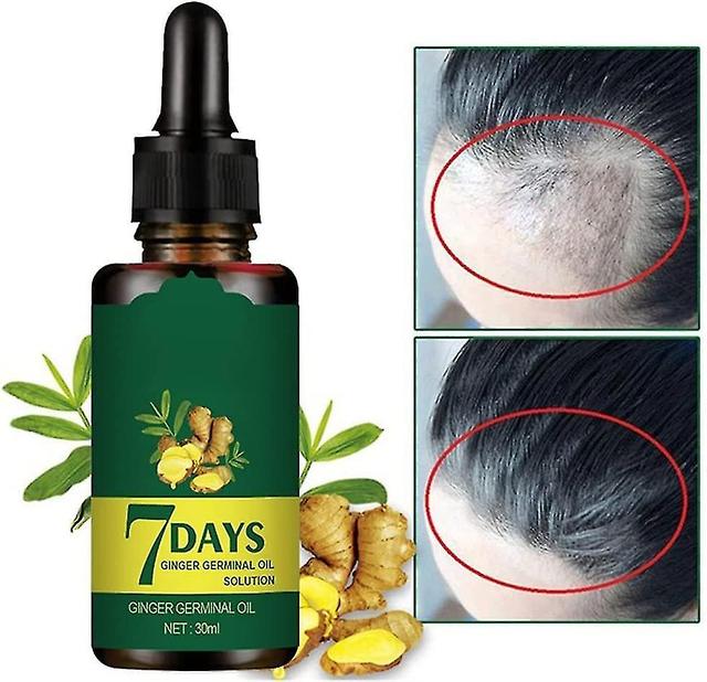 Ginger Growth Germinal Oil Regrow 7 Days Ginger Germinal Serum For Nourishing Roots 50ml on Productcaster.