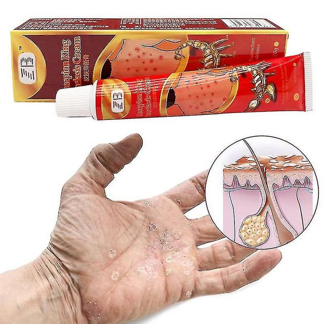 20g Scorpion Venom Psoriasis Cream Antipruritic Ointment For Pruritus Eczema Der on Productcaster.