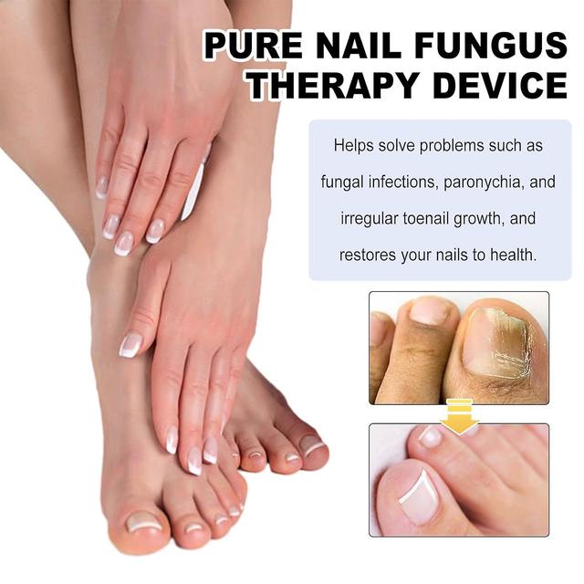 Fungus Laser Therapy Device, Light Therapy Device Fungal Nail, Revolutionary High-Efficiency Light Therapy Device for Toenail Diseases -GSL 2 pcs on Productcaster.