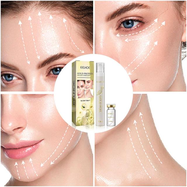 Finiss Protein Thread Lifting Set | Soluble Protein Thread And Nano Gold Essence Combination | Absorbable Collagen Thread For Face Lift on Productcaster.