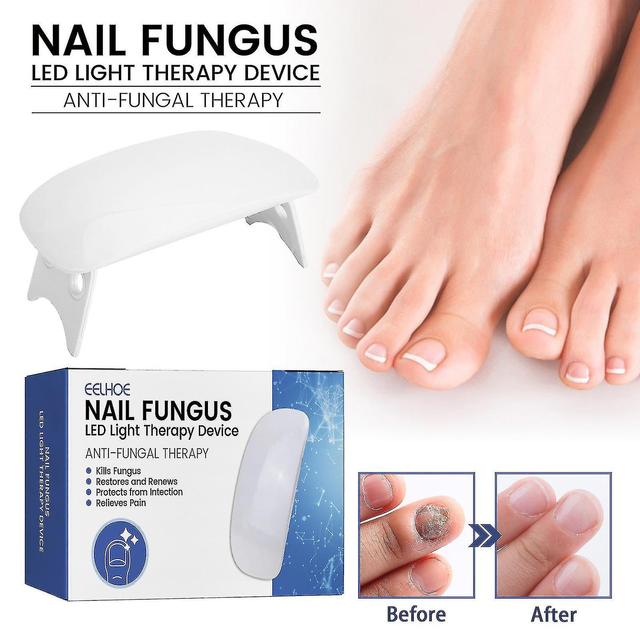 Pinguo Nail Led Light Therapy-device,nail Repair Instrument To Prevents Broken Nails And Rotten Nails 1 on Productcaster.