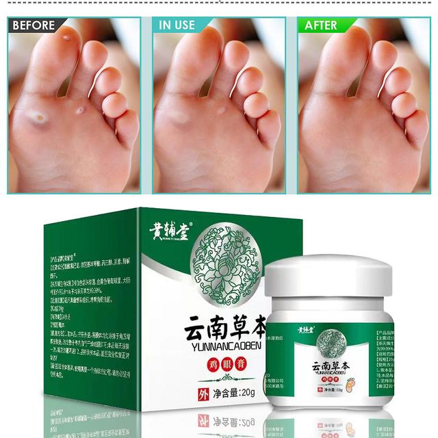 Gaoguang Pansement de maïs super fort à base d’extraits naturels de plantes pour les pieds et le corps 20g 20231120 Blanc on Productcaster.