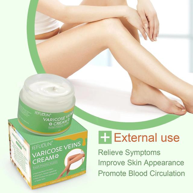 Ninesun 50ml Red Blood Streaks Varicose Vein Ointment Remove Varicosity Veins Angiitis Medical Plaster Vasculitis Phlebitis Spider Cream on Productcaster.