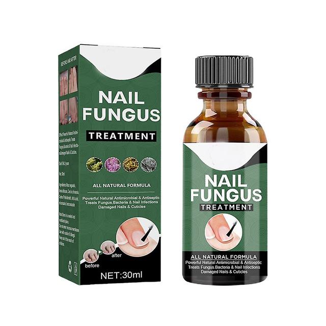 Toenail Fungus Treatment Liquid Gental Natural Ingredients Anti-Nail Fungus Liquid for Repairing Ony 30ML on Productcaster.