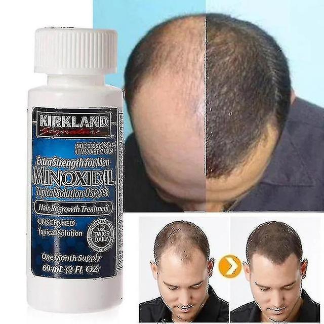 Hair Growth Essence Natural Herbal Health Care Treatment for Loss 50ml_Jan on Productcaster.