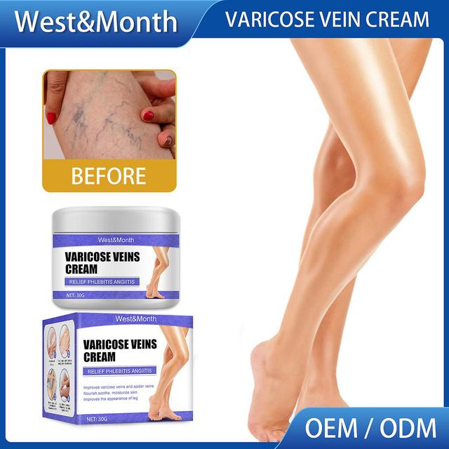 Finiss Leg Varicose Vein Repair Cream | Veins Herbal Ointment Cream | Relaxing Leg Cream To Natural Sooth Leg Spider Veins And Varicose Veins on Productcaster.