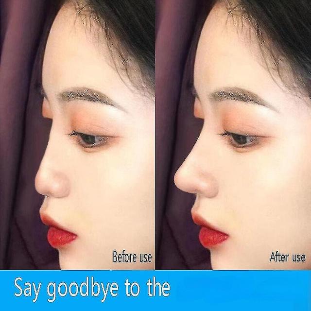 NAILAO 2pcsnewly Upgraded Rhinoplasty Essence Essential Oil Meiqiao Essence Beauty Skin Care Quick-acting L on Productcaster.