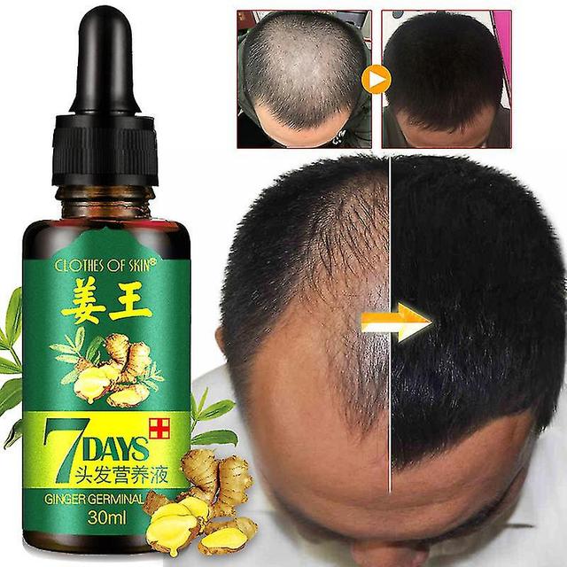 Mike 30ml Ginger King Hair Nutrient Solution Spot Raw Liquid Plant Hair Care Hair Care Essentiële Olie on Productcaster.