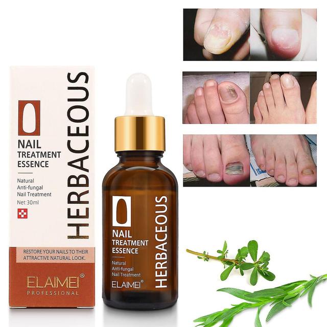 Black Friday 2023 Toenailplus Anti-paronychia Relief Oil Ingegroeide teennageldruppels Correctie Teennagel Dus on Productcaster.