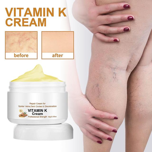 Vitamin-K-Creme, Premium-Formel für Blutergüsse, Besenreiser, Augenringe, geplatzte Kapillaren, Augen und Gesicht 60g-3 on Productcaster.