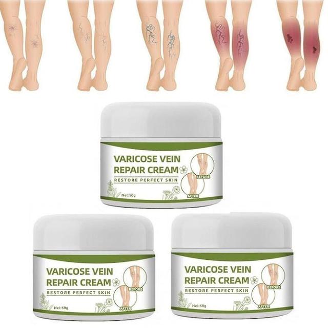 Krampfadern-Creme, Beinpflegecreme, Spinnenbein-Reparaturcreme zur Reparatur von Besenreisern, Krampfadern und Besenreisern 3Stk. on Productcaster.