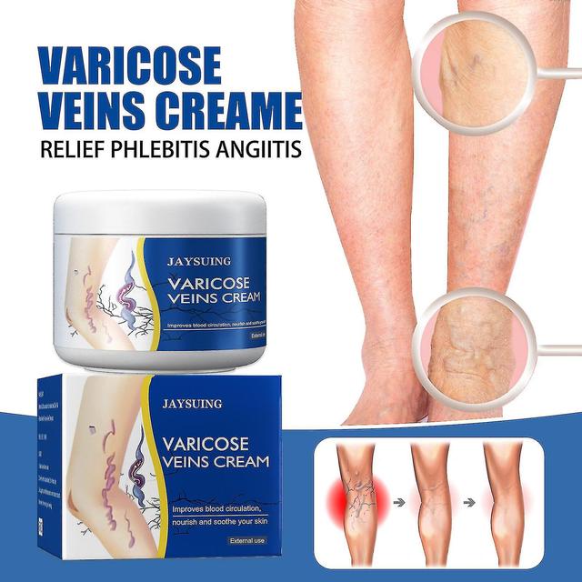 Syhsj Jayng Leg Vein Cream Masaż żylaków Ból nóg Obrzęk Aktywujący Collateral External Cream | Fruugo Polska on Productcaster.