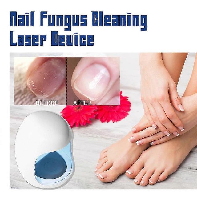 Nail Fungus Laser Treatment Device Repair Toenail Fingernail Fungus Treat Onychomycosis Therapy Cure on Productcaster.