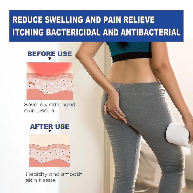 Two Pack Hemorrhoids-breaking Cream Eliminate Meatballs Hemorrhoids-breaking Relief Swelling Sore Internal And External Acne Mixed Anal Shu Care Cream on Productcaster.