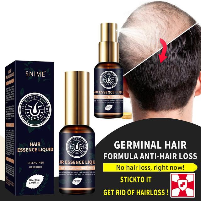 Flye Ginseng, Gember, Zwart Sperma Sesami Nigrum Essence Haar 30ml, Weerstand-haaruitval etherische olie A on Productcaster.