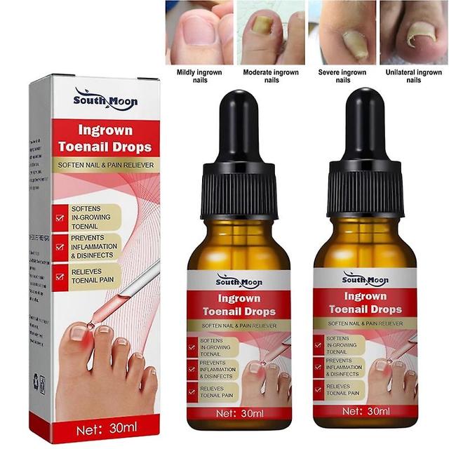 30/60/90ml Ingrowth Toenail Correction Treatment Oil Ingrown Toenail Repair Drops 60ML on Productcaster.