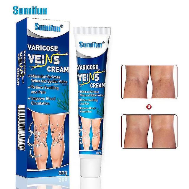 Varicose Veins Cream Eliminate Varicose Veins And Spider Veins,improve Blood Circulation Soothing Leg Cream 3Pcs on Productcaster.