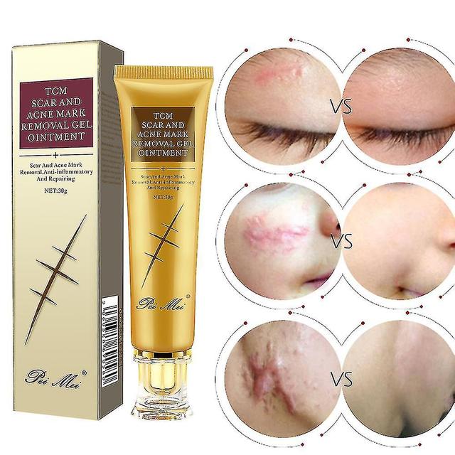 High-quality Pei Mei Scar Acne Stretch Mark Removal Ointment Gel Cream Wounds Cuts Burns on Productcaster.