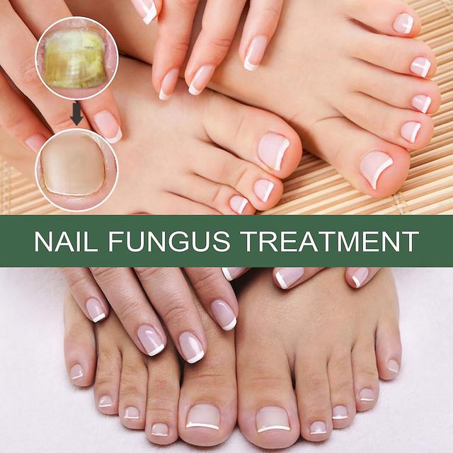 Nail Repair Extra Strength Nail Toenail And A Solution Nails And Nails Repair Damaged And Discolored Nails 50 ml on Productcaster.