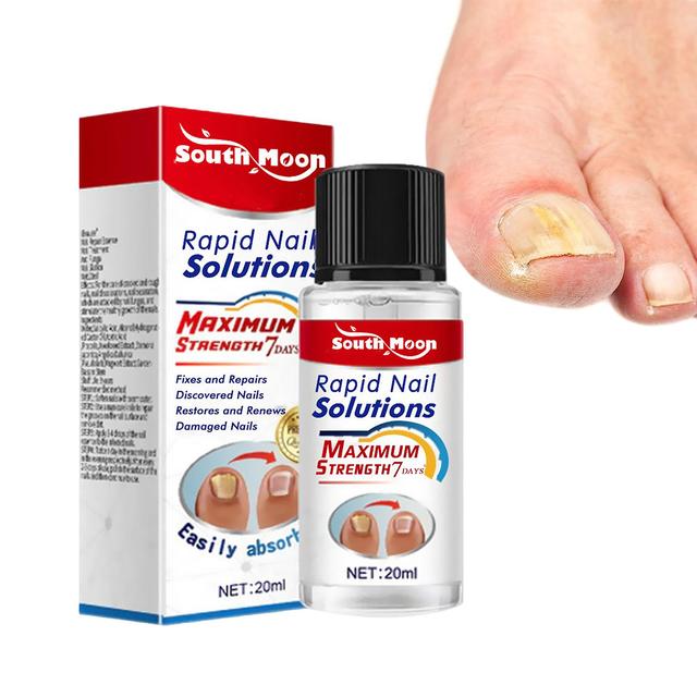 Nail Repair Serum Nail Fungal Care Serum Anti-infection Onychomycosis Paronychia Treatment Serum For Hand Foot Nail Repair A on Productcaster.