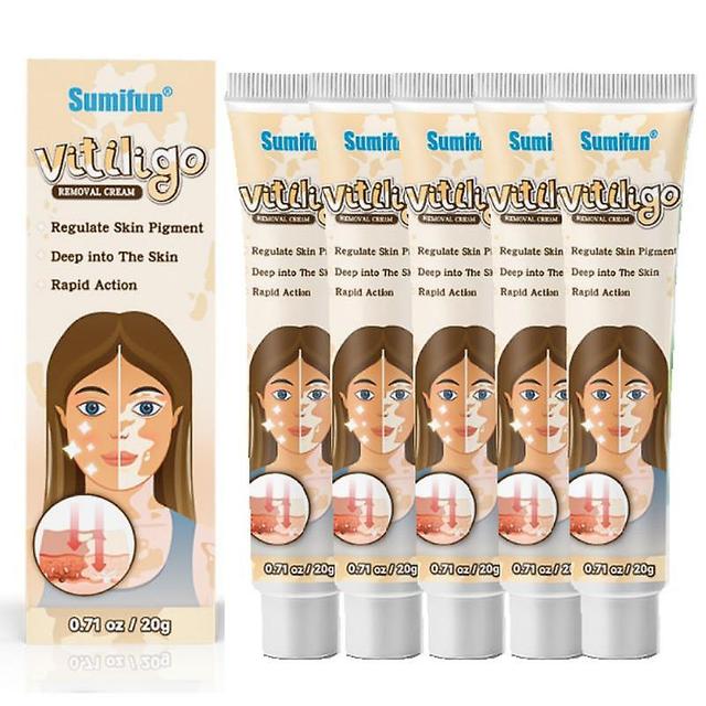 5x Herbal Extract Vitiligo Ointment Remove Ringworm White Spot Removal Skin Vitiligo Eliminate Vitiligo Treatment Cream on Productcaster.