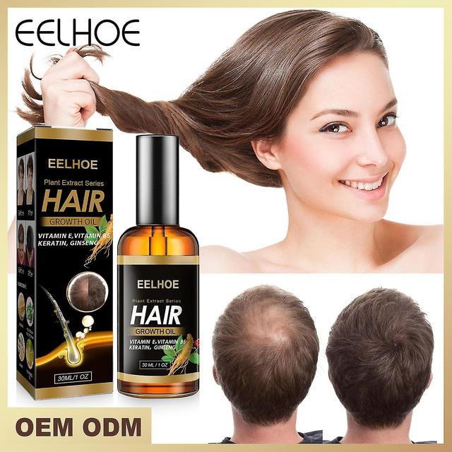 Hair Loss Serum Hair Care - Long Hair Growth 30ml Vitamin E Oil - Natural Ginseng Hair Growth Thickening Essence Oil on Productcaster.