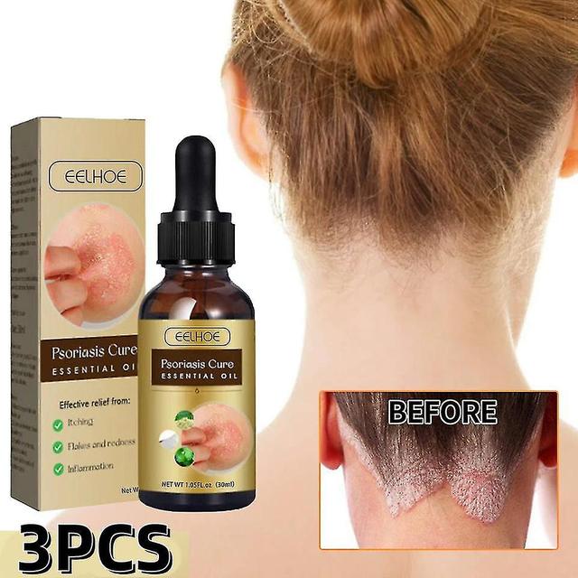 3pcs Psoriasis Repair Essential Oil on Productcaster.