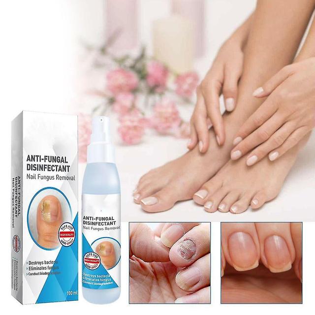 Ofocase Nail Strengthener Spray för trasiga spruckna delade svaga naglar, nageltillväxt reparation, slutar peeling, splittringar, flisor, sprickor ... on Productcaster.