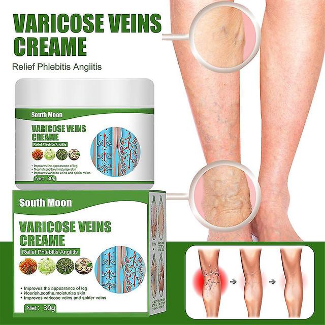 3pcs Cremevital Varicose Vein Creamcremevital Varicose Cream,varicose Vein Cream For Legs,eliminate Varicose And Veins,relieve Pai on Productcaster.