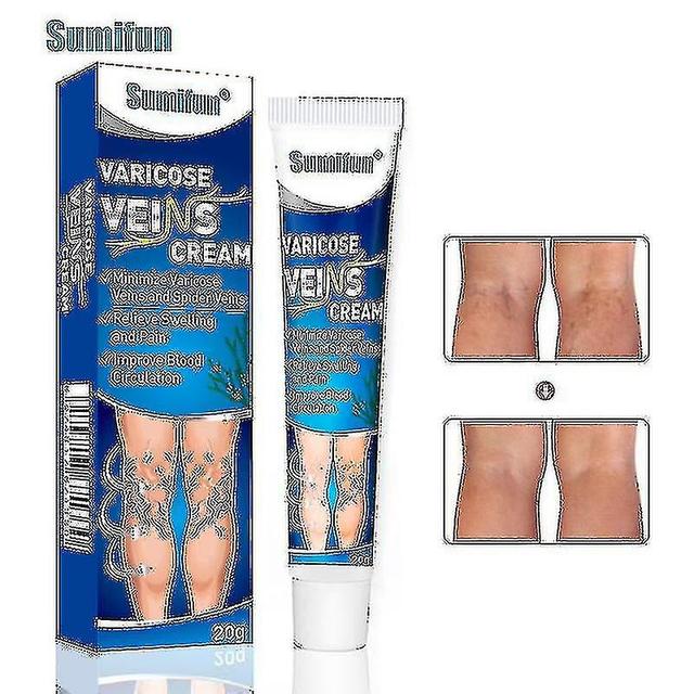 2PCS Varicose Veins Cream Eliminate Varicose Veins And Spider Veins,improve Blood Circulation Soothi on Productcaster.