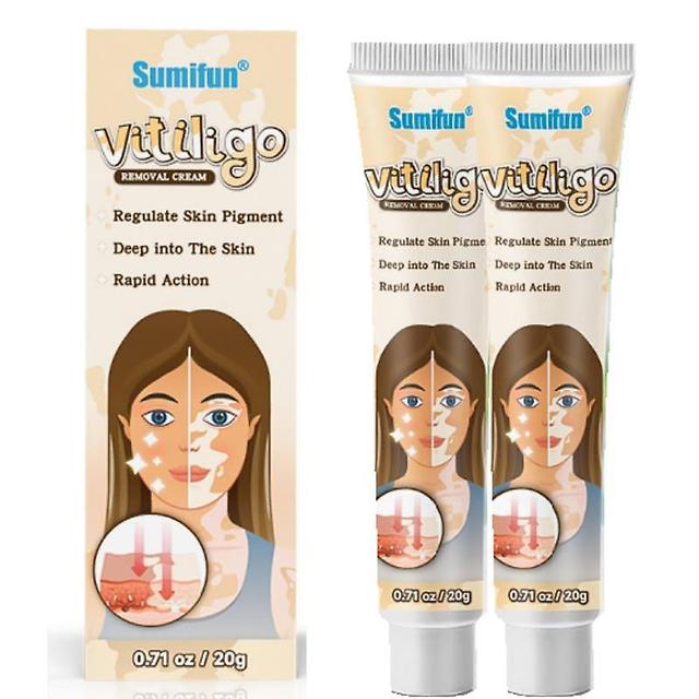 2x Herbal Extract Vitiligo Ointment Remove Ringworm White Spot Removal Skin Vitiligo Eliminate Vitiligo Treatment Cream on Productcaster.