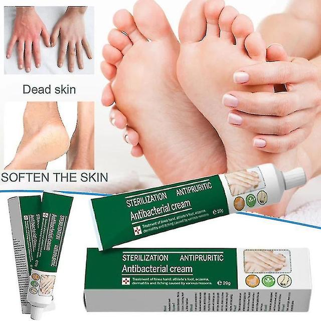 Unguento a base di erbe da 20 g perfetto per Eczema Tinea Hand & Thlete's Foot Treatment Cream Uso esterno on Productcaster.