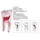 Easyget 12 Size 1:1 Dental Rct Endo Training Teeth Model 3d Curved Root Teeth Model Lower Molar B-1PC on Productcaster.