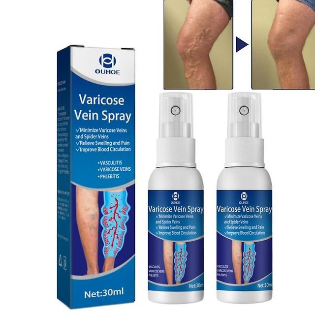 2pcs Spray For Varicose Veins Effective Varicose Vein Relief Cream To Relieve Leg Vasculitis Phlebitis Spider Pain Swelling Body Care on Productcaster.