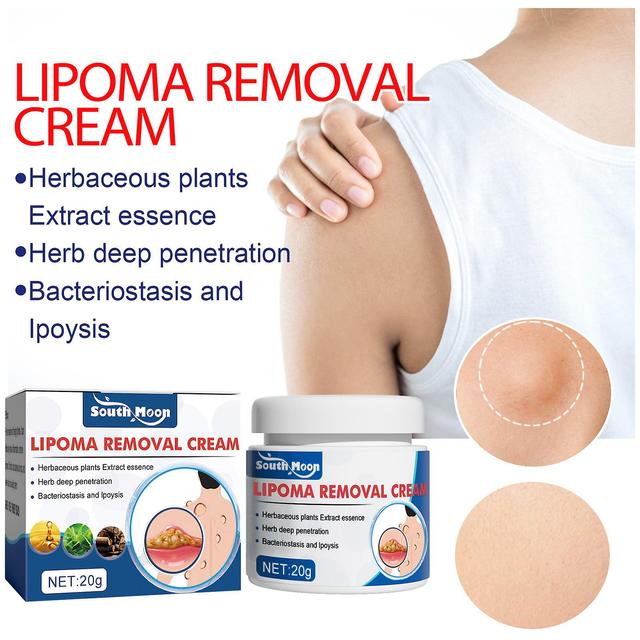 South Moon Cellulite Cream Repairs Fat Cakes, Hard Bumps, Subcutaneous Bumps, Body Health Care Cream 20g box on Productcaster.