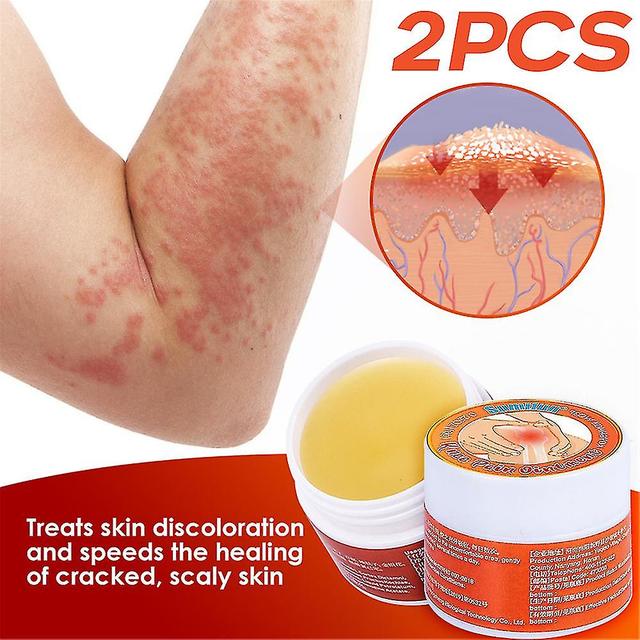 10g Herbal Psoriasis Cream Joint Knee Neck Shoulder Care Cream 2PCS on Productcaster.