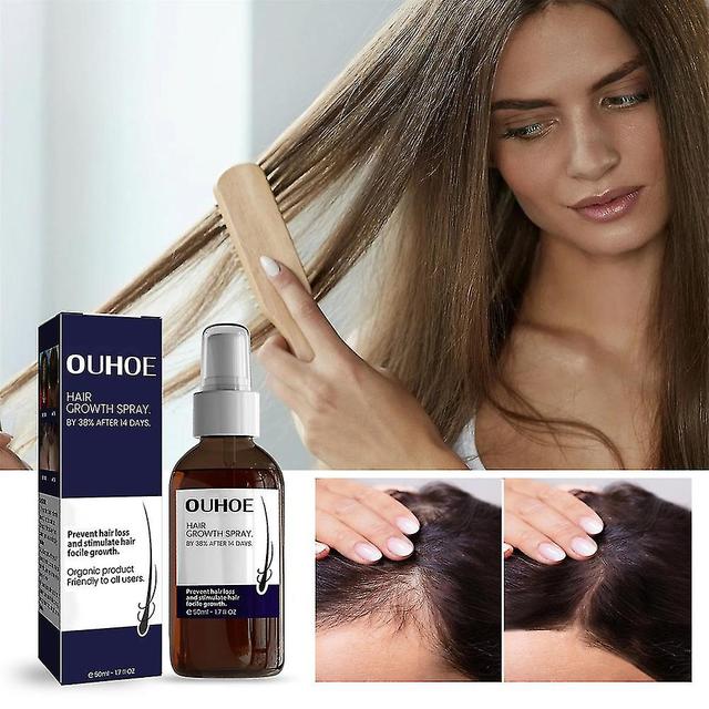 3x 50ml Blusoms Hairgrowth Formula Serum Spray, Ashwagandha 4500 Hair Growth Spray OEMG on Productcaster.