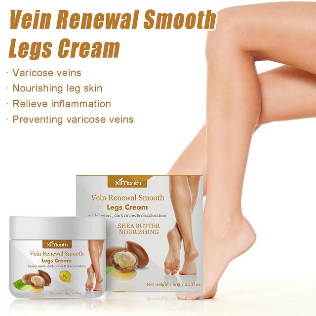 Flye Varicose Veins Cream, Varicose Veins Cream, Varicose Veins For Legs, Spider Vein For Legs, Varicose Veins Relief Cream White on Productcaster.