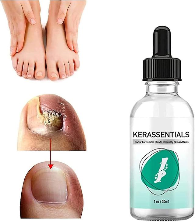 Kerassentials Toenail Fungus Treatment Oil , Best Repair Solution For Fingernails And Toenails , Fix & Renew Damage Fungal Nail, Broken, Cracked & ... on Productcaster.