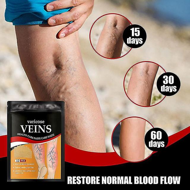 Varicose Vein Patch For Spider Veins Varicose Veins Removal Leg Care Improves on Productcaster.